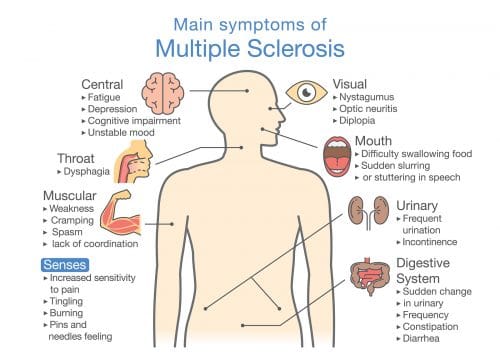 esclerosis multiple diagnostico, esclerosis multiple tratamiento, esclerosis multiple wikipedia, esclerosis multiple definicion, esclerosis multiple consecuencias, que es la esclerosis multiple